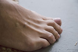 Photo: Foot and toes